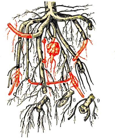 Обрезка скелетных корней